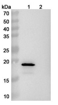 SNCA/Alpha-synuclein Human Monoclonal Antibody