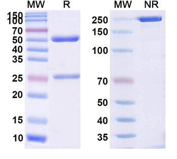SNCA/Alpha-synuclein Human Monoclonal Antibody