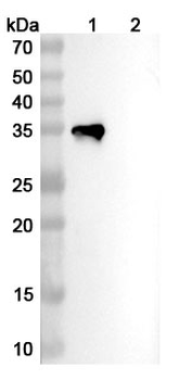 TREM2 Human Monoclonal Antibody