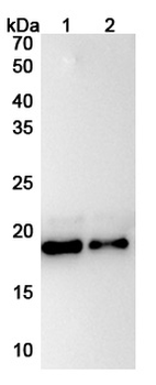 IL11 Human Monoclonal Antibody