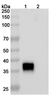 Reozalimab Human Monoclonal Antibody