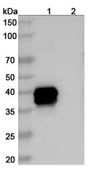 Belantamab Human Monoclonal Antibody