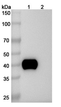 Enfortumab Human Monoclonal Antibody