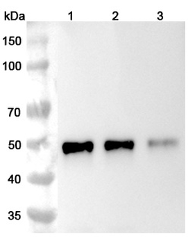 Ibalizumab Human Monoclonal Antibody