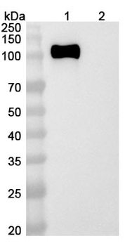 Rosopatamab Chimeric Monoclonal Antibody