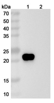 Ragifilimab Human Monoclonal Antibody