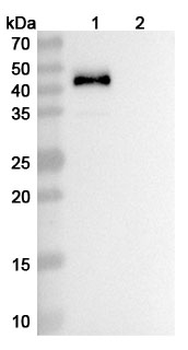 Vopratelimab Human Monoclonal Antibody