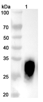Iladatuzumab Human Monoclonal Antibody