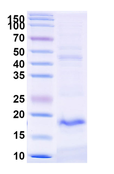 Common timothy PHLPVI/Phl p 6 Nanobody Antibody
