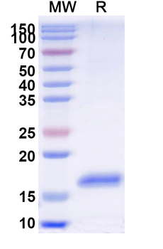 Human GBA Nanobody Antibody