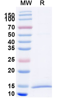Human CD158a/KIR2DL1 Nanobody Antibody