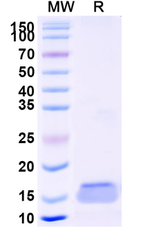 Human PTK7/CCK-4 Nanobody Antibody