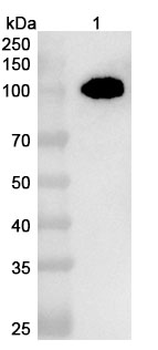 Human PTK7/CCK-4 Nanobody Antibody