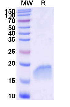 Human CAVIN1 Nanobody Antibody