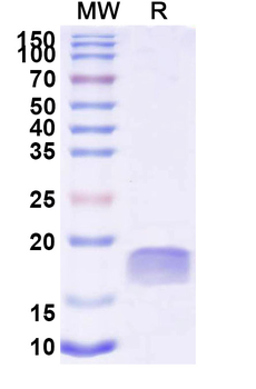 Human TTYH2 Nanobody Antibody