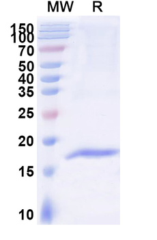 Human ACKR1/CD234 Nanobody Antibody
