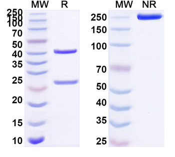 Human GRIN1/NMDAR1 Antibody