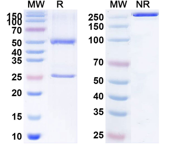 Hepatitis E virus/HEV E2s domain Antibody