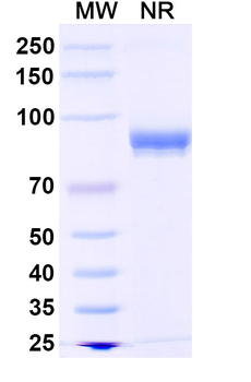 HeV/NiV Fusion Protein Antibody
