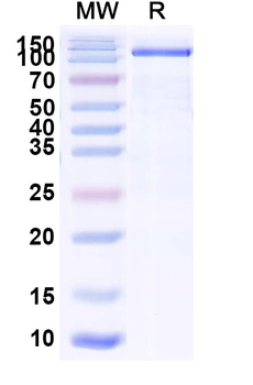 Recombinant Human CD21/CR2 Protein, C-His