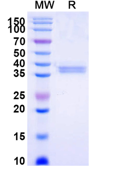 Recombinant Mouse CD45/PTPRC Protein, C-Fc