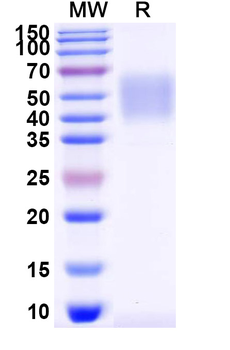 Recombinant Mouse CD80 Protein, C-His