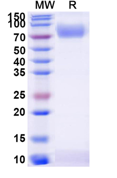 Recombinant Human CD119/IFNGR1 Protein, C-Fc