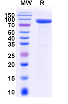 Recombinant Mouse SFRP5 Protein, C-Fc