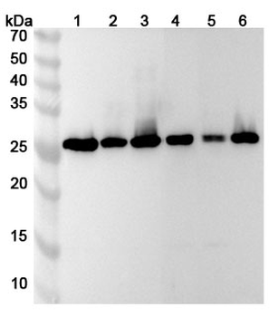 NAA10 Polyclonal Antibody