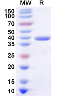 Recombinant Human SARS1 Protein, N-His