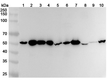 ST13 Polyclonal Antibody