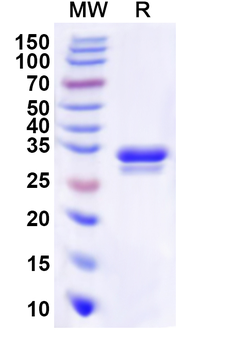 Recombinant Human ABCD1 Protein, N-His