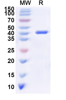 Recombinant Human ADPRH Protein, N-His