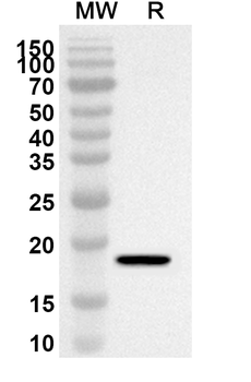 BRMS1L Polyclonal Antibody