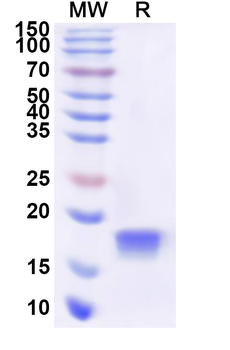 Recombinant Human UBE2N Protein, N-His
