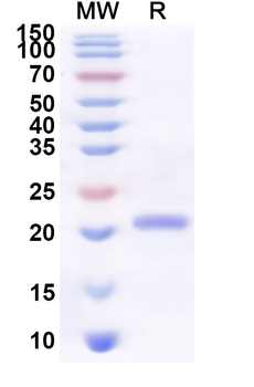 Recombinant Human ACVR2B Protein, N-His