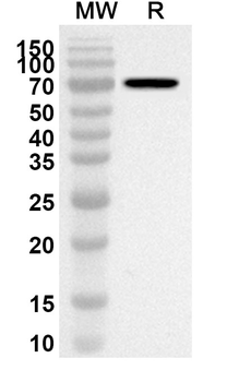 Human PSRC1 Polyclonal Antibody