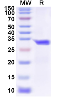 Recombinant Human ATG10 Protein, N-His