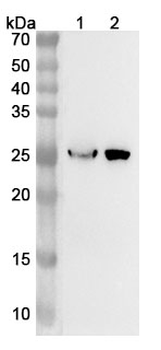RABAC1 Polyclonal Antibody