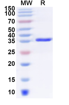 Recombinant Human TIMM17B Protein, N-GST & C-His