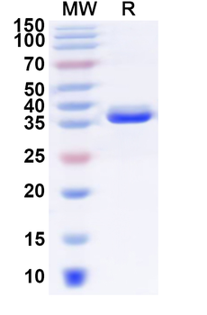 Human SLC7A5 Recombinant Protein (N-GST & C-His)