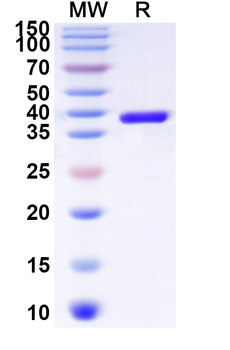 Human YAF2 Recombinant Protein (N-His-KSI)