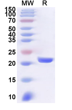 Human MORF4L2 Recombinant Protein (N-His)