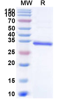 Recombinant Human SMARCB1 Protein, N-His