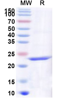 Human SCD5 Recombinant Protein (N-His)