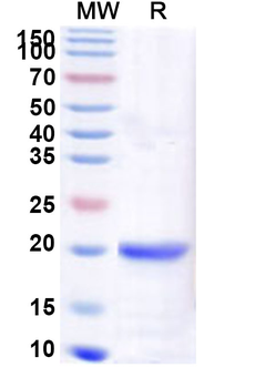 Human ZBED1 Recombinant Protein (N-His)