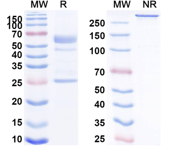CHIKV Spike glycoprotein E2 Antibody