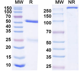 HIV-1 Envelope glycoprotein gp160 Antibody
