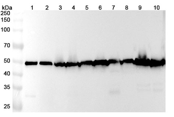 Human TUBB/Beta Tubulin Antibody