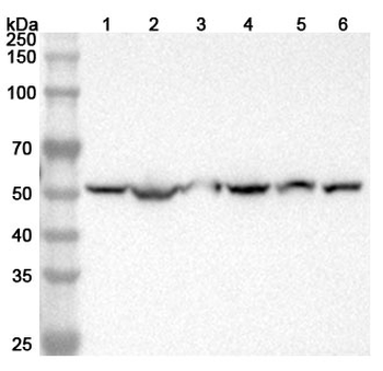Human HARS1/jo-1 Antibody